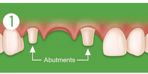 Missing image, cannot generate ALT, caption, or description.