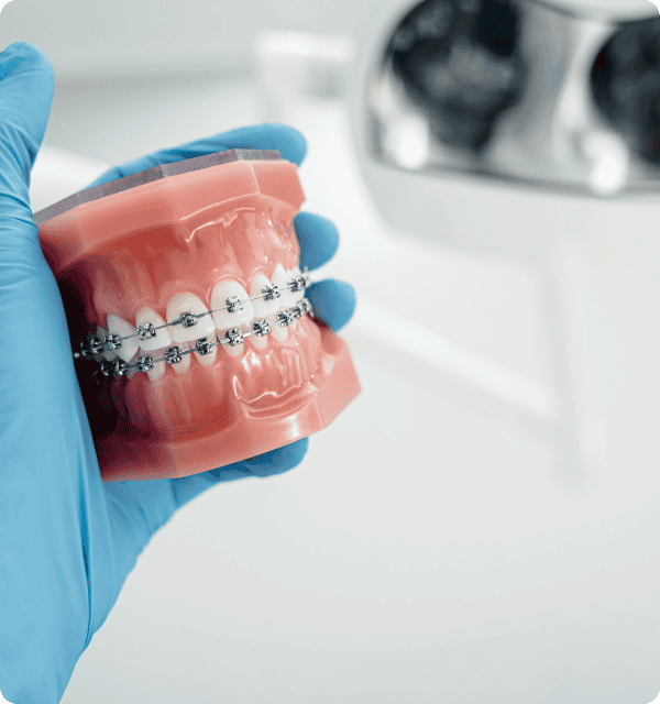 Braces in Nelspruit being installed