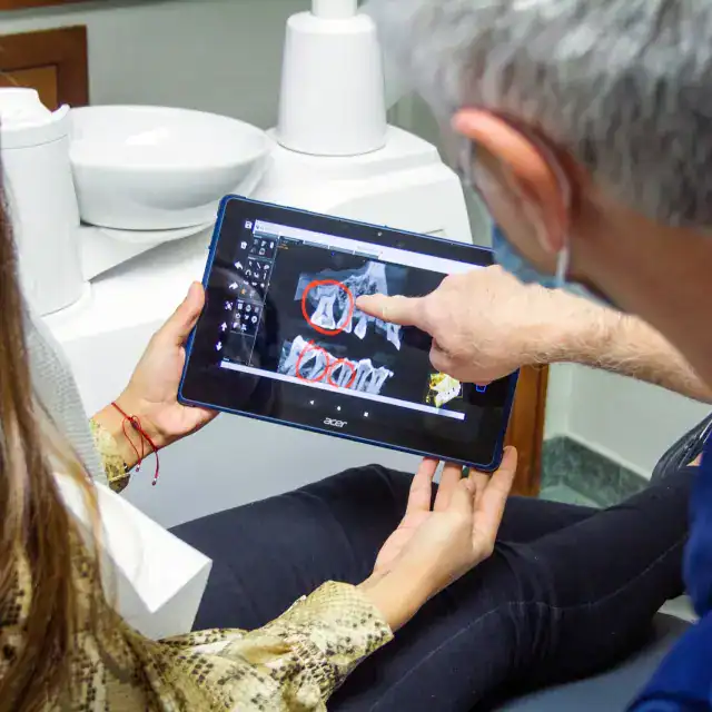 Assessment of Dental crowns in Nelspruit